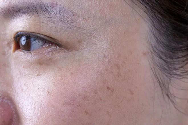 道我在雪场被晒得很曼妙不朽情缘mg网址不知(图3) 道我在雪场被晒得很曼妙不朽情缘mg网址不知(图3)